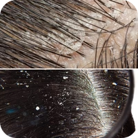 Unhappy Scalp